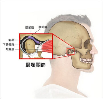 顳顎關節症候群 Dr Sky 名冠診所