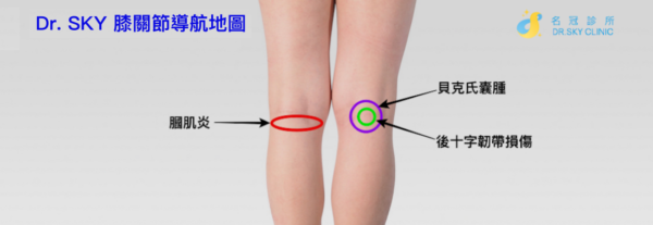 Dr Sky 膝關節痛導航地圖12種膝關節病因一次看懂 Dr Sky 名冠診所